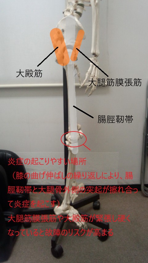 腸脛靭帯の図